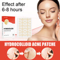 72-Count Acne Patch — Nighttime Spot Stickers for Face & Skin